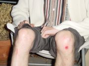 Ouch!